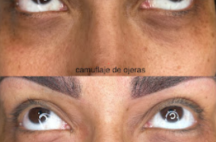 Especialista Jackeline Martinó realizando tratamiento de camuflaje de ojeras con maquillaje permanente en su clínica de Bayamón, Puerto Rico.