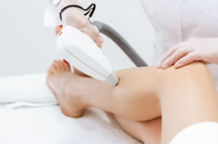 Tratamiento de depilación láser en piernas completas para resultados impecables en Mauroma Hair Removal & More.