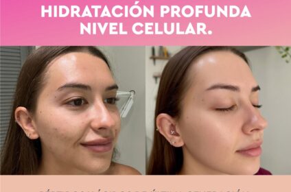 Tratamiento de hidratación profunda a nivel celular para una piel radiante en Skin by Susan & Brow Studio, Mayagüez