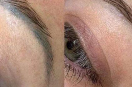 Remoción de pigmento en cejas permanentes con tecnología avanzada en Original Skin Co.
