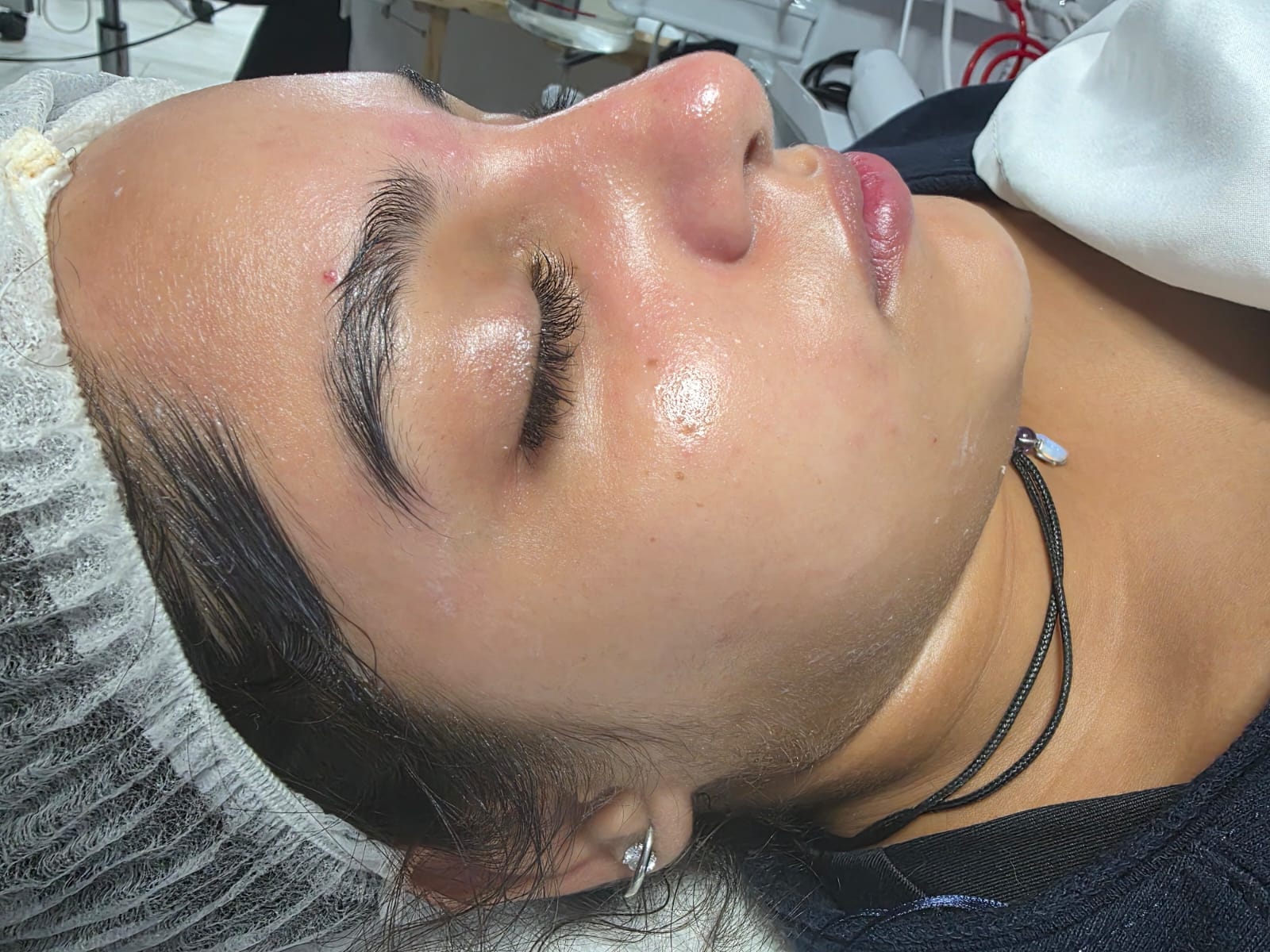 LIMPIEZA FACIAL PROFUNDA - Image 2