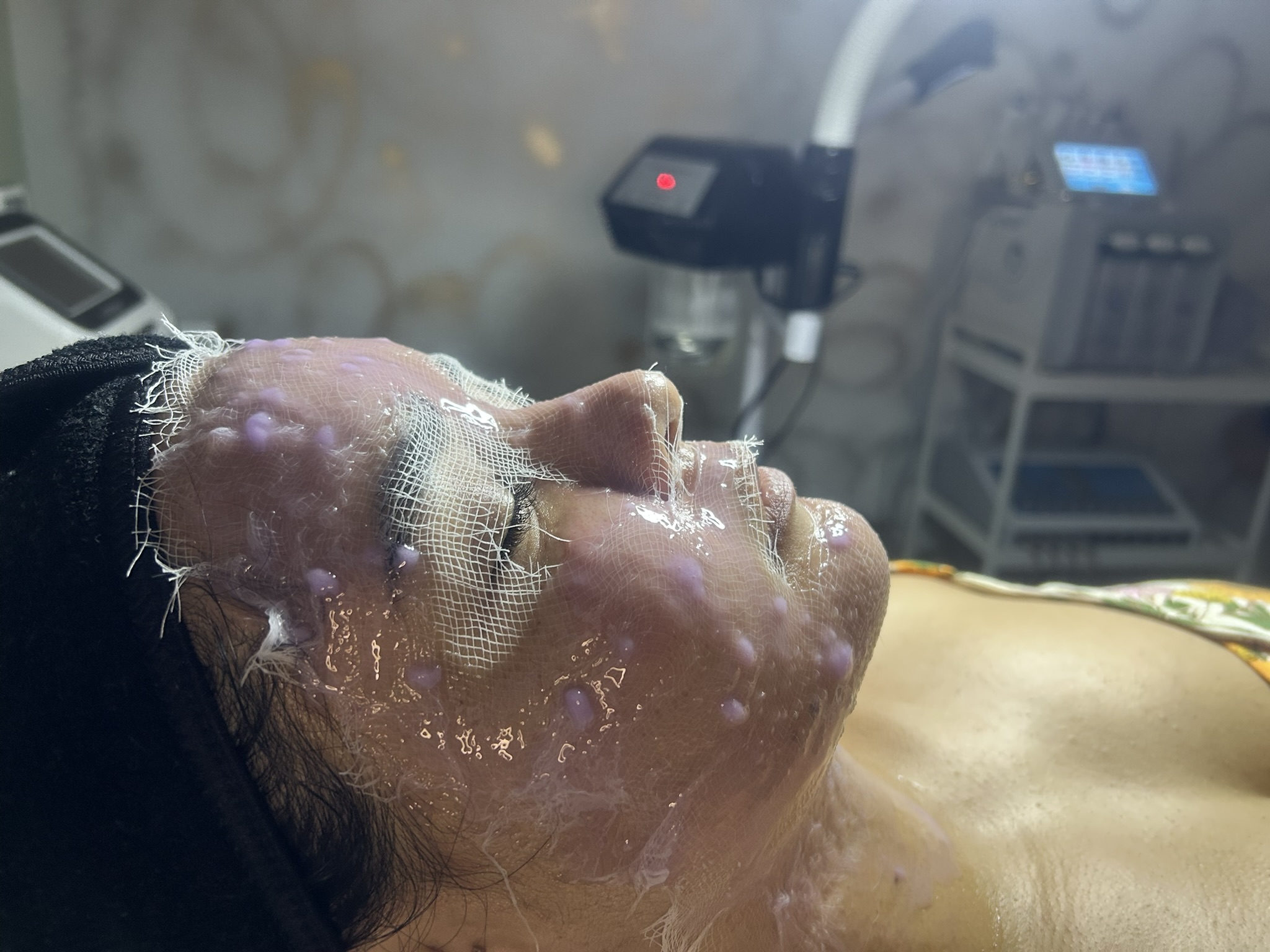LIMPIEZA FACIAL PROFUNDA - Image 3