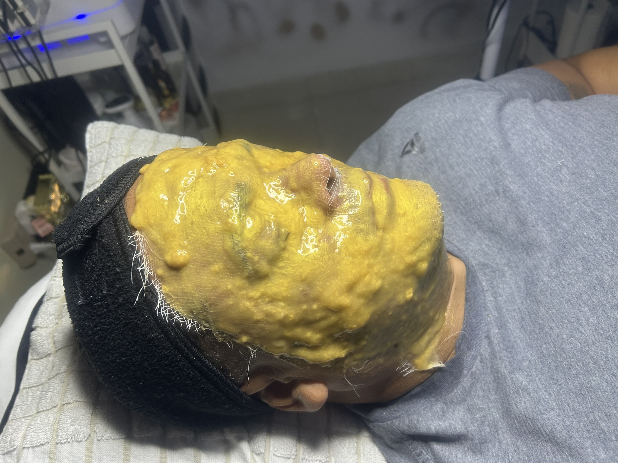 LIMPIEZA FACIAL PROFUNDA - Image 4